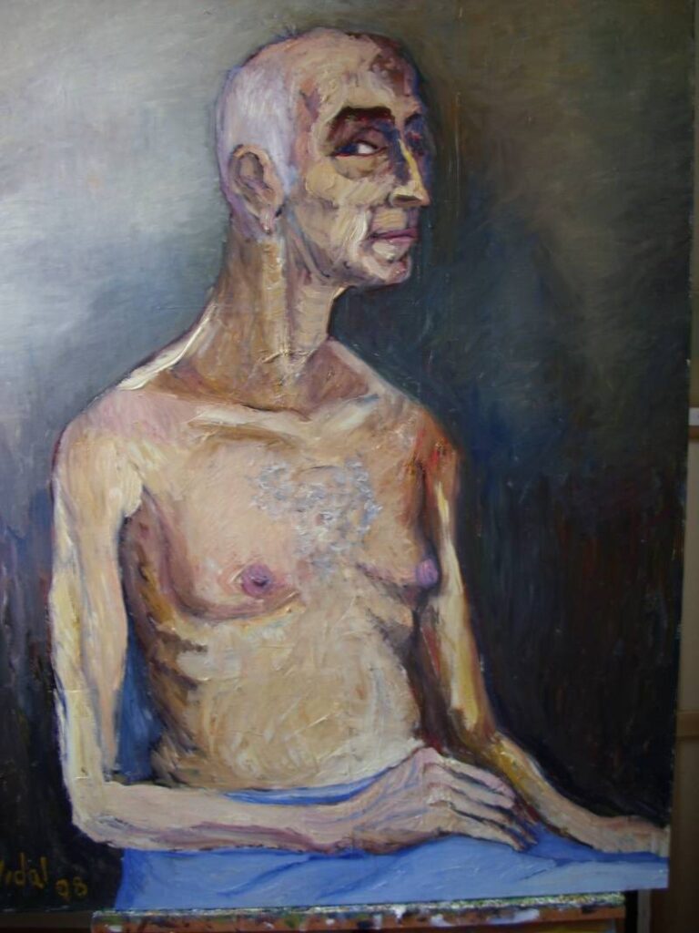 paciente de dialisis, Vidal Alcolea